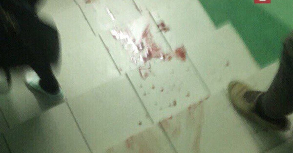 Подростки умышленно напали на школу в Перми, после чего нанесили удары ножом друг другу - СК РФ