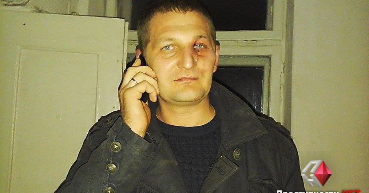 Одному з активістів куля потрапила в брову. / © Преступности НЕТ