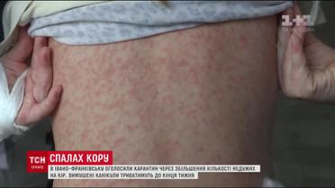 В школах Ивано-Франковска из-за кори объявили карантин