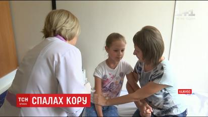 В Києві за вихідні зареєстрували 20 нових випадків захворювання на кір