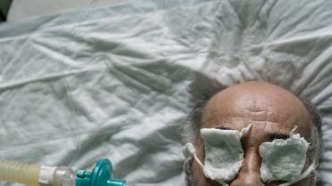 коронавірус, лікарня в Чернівцях_7 / © Associated Press
