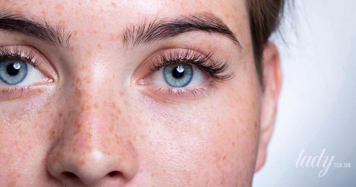 Пігментна дисперсія чи глаукома