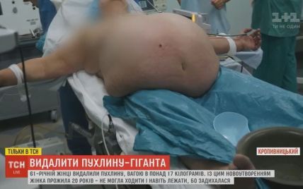 17-кілограмову пухлину видалили пацієнтці в Кропивницькому
