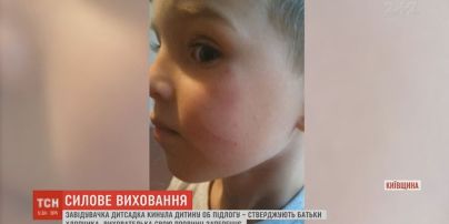 На Киевщине заведующую детсадом обвинили в избиении 5-летнего воспитанника