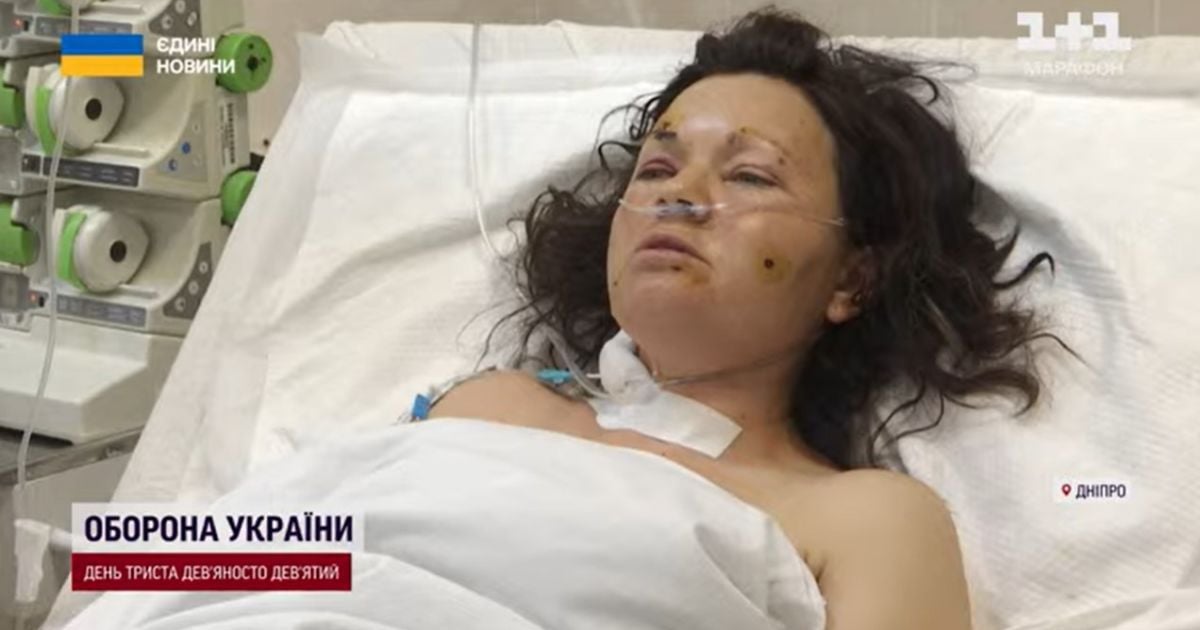 Разыскала тело пропавшего еще в апреле солдата и взорвалась на растяжке: в Днепре спасают кинолога