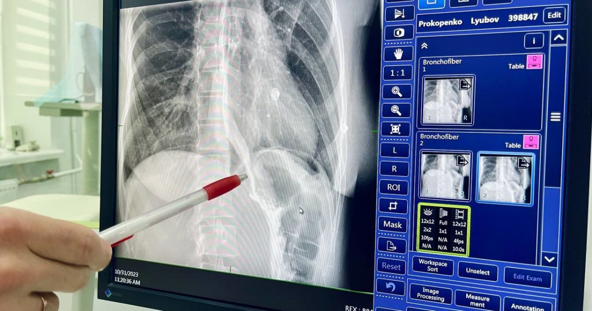 Сверхсложную операцию провели во Львове. Пациентка 6 лет не могла есть и худела на глазах Фото Первого медицинского объединения Львова.