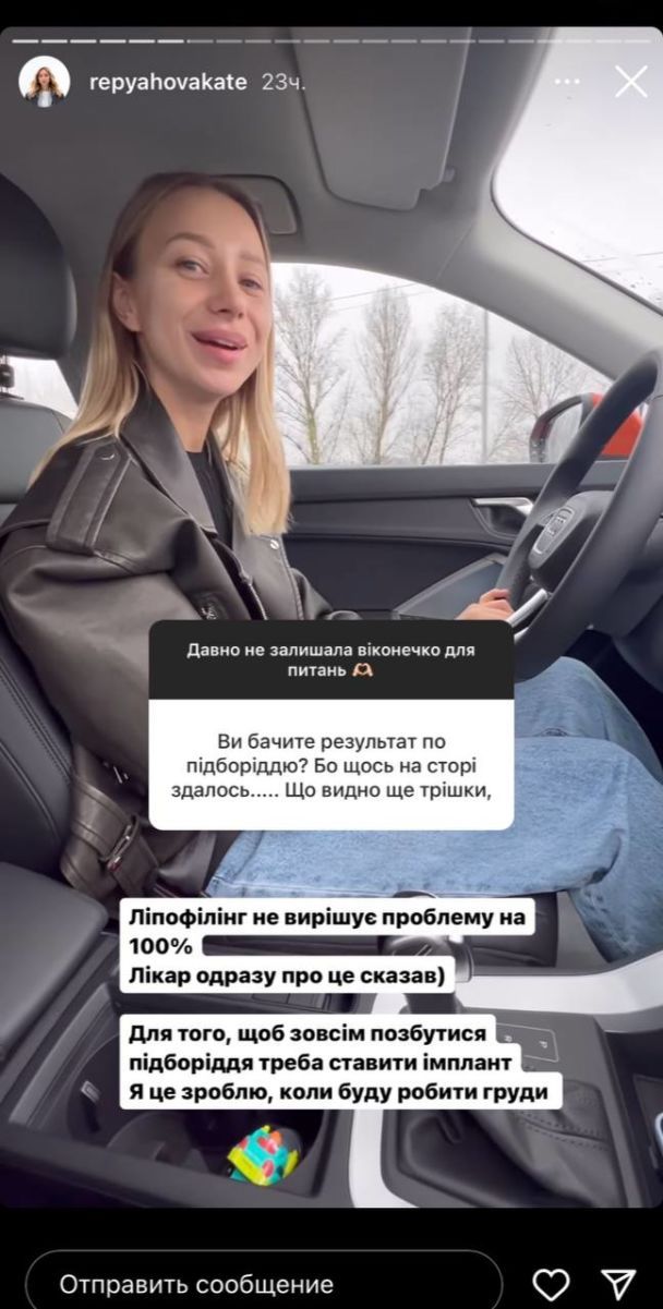 Екатерина Репяхова / © instagram.com/repyahovakate