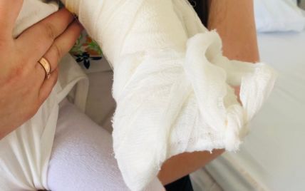 Львовские врачи успешно удалили лишний большой пальчик восьмимесячной девочке