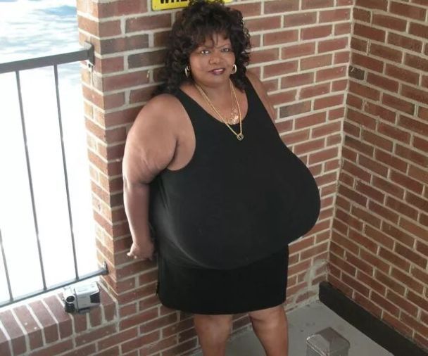 Самая большая грудь в мире: фото Энни Хокинс-Тернер — ТСН, новости 1+1 — Курьезы