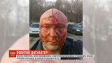 В Киеве избили скандального догхантера Алексея Святогора