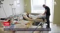 Новости Украины: детей, которых госпитализировали из-за укусов гадюки, лечат симптоматически