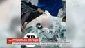 В запорожскую больницу обратился мужчина с навороченной гайкой на половом органе