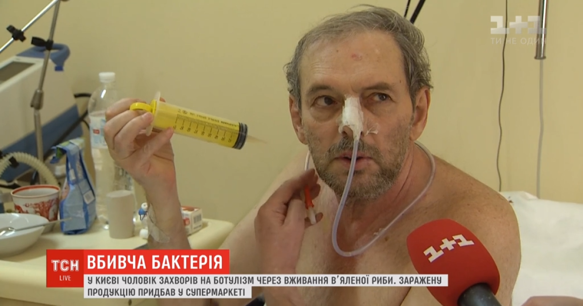Киянин з'їв в'яленої риби і потрапив з ботулізмом до реанімації