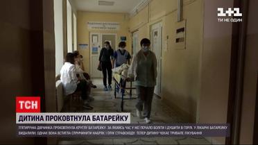 Новини України: у Львівській області п’ятирічна дівчинка проковтнула батарейку 