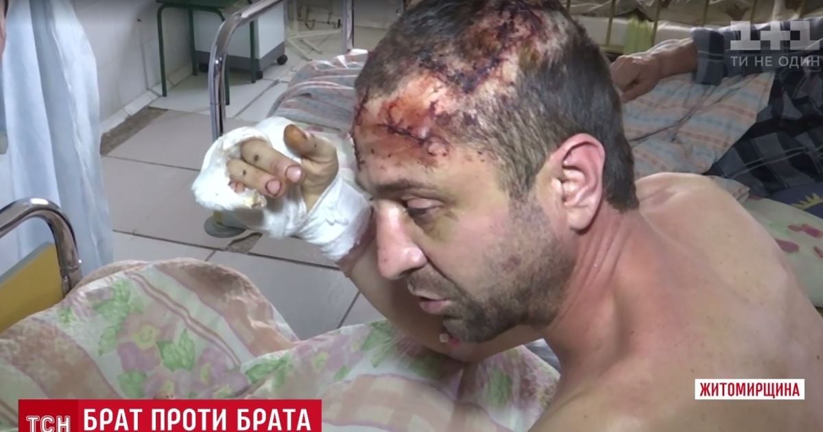 На Житомирщині підполковник міліції жорстоко катував брата через спадок