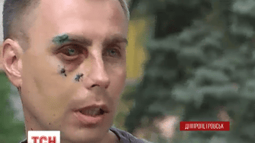 У Дніпропетровську мажор жорстоко побив працівника СТО