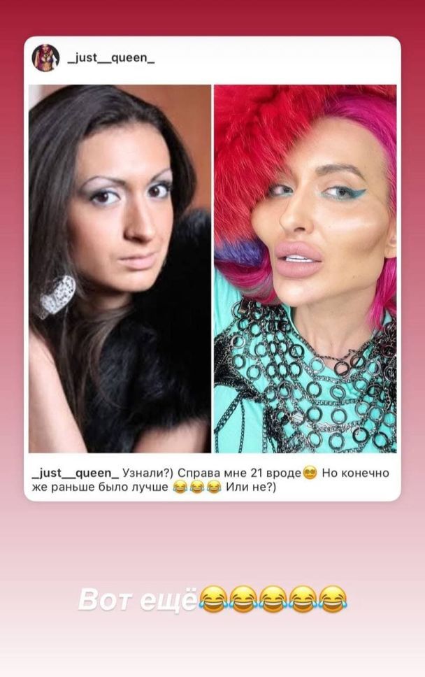Анастасия Покрещук до и после пластики / © instagram.com/_just__queen_