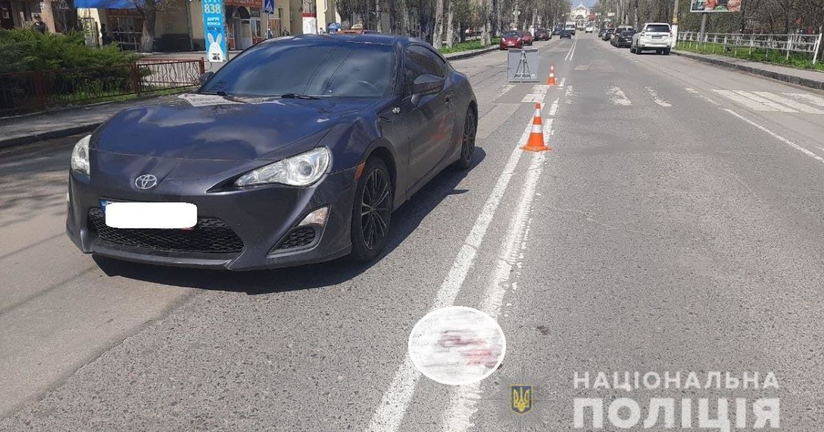 В Херсоні авто збило дитину, яка була на переході: хлопчик у важкому стані