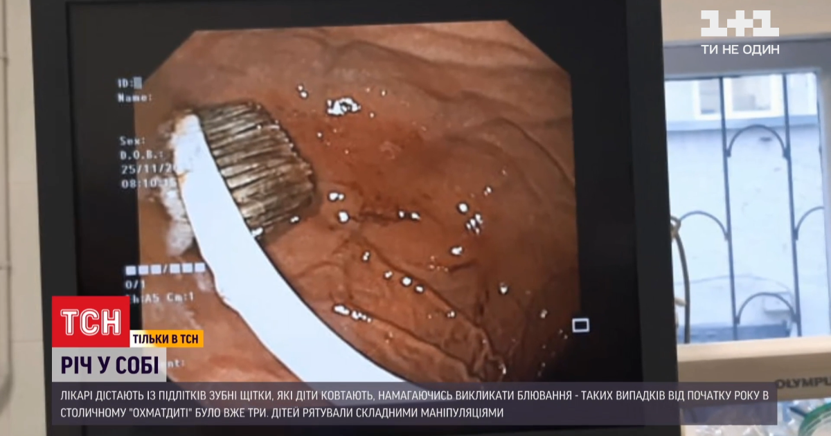 В "Охматдиті" зі шлунка дівчини дістали зубну щітку: це вже третій випадок за рік