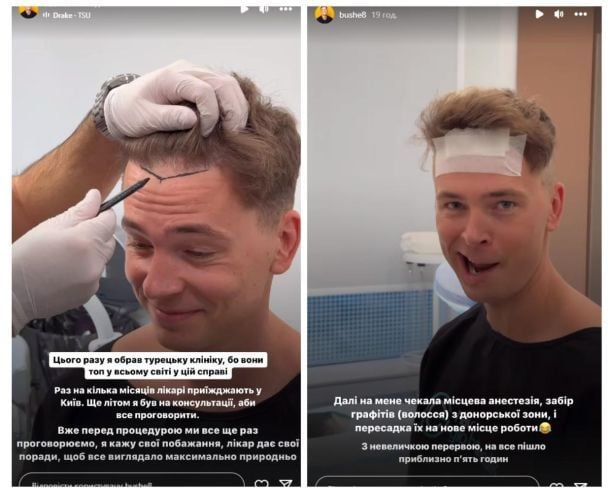 Богдан Шелудяк зробив операцію / © instagram.com/bushe8