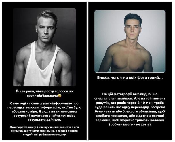 Богдан Шелудяк зробив операцію / © instagram.com/bushe8