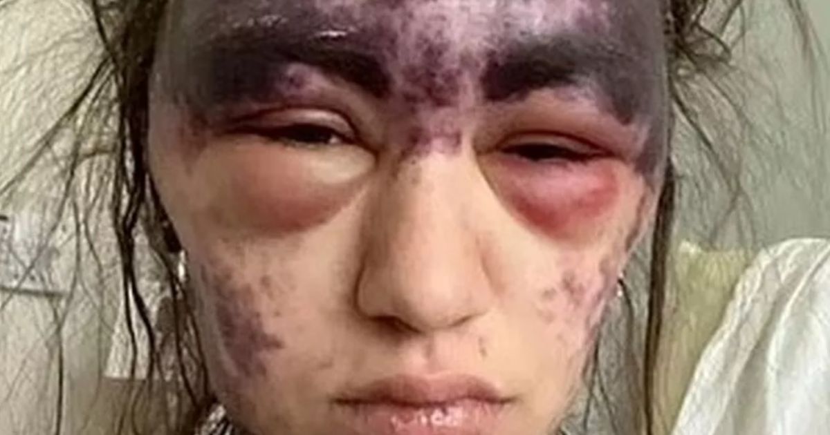 Алексис Лоренце / Фото: Facebook