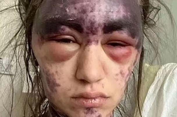 Алексис Лоренце / Фото: Facebook