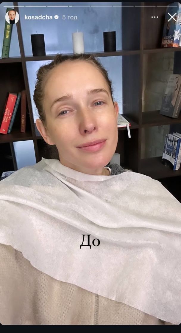 Екатерина Осадчая до макияжа / © instagram.com/kosadcha