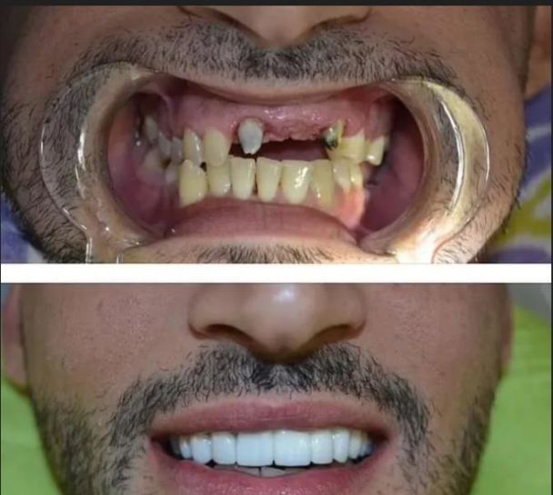 Ексчоловік Брітні Спірс Сем Асгарі мав проблеми з зубами / © instagram.com/samasghari
