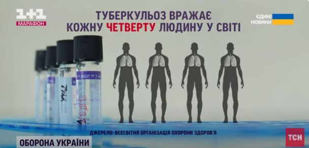 Туберкульоз вражає кожну четверту людину в світі