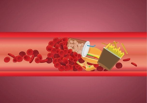 Как снизить холестерин в домашних условиях: как улучшить самочувствие без лекарств