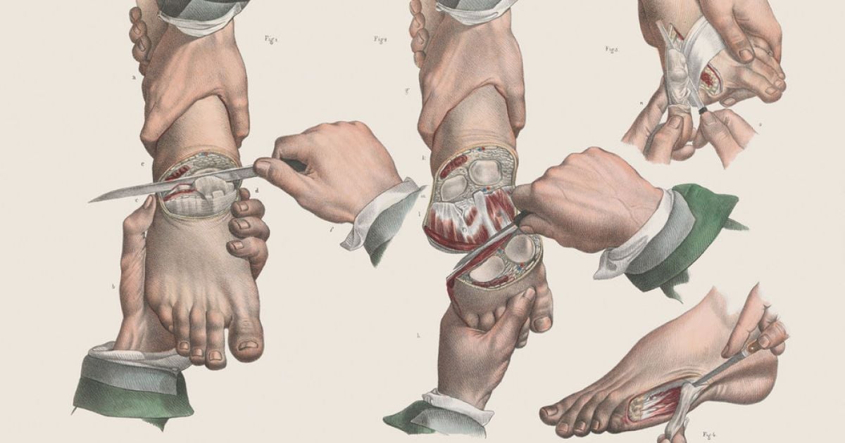 Хірургія 19-го століття. / © thamesandhudson.com