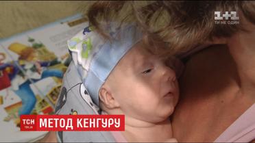Малюки-нетерплячки: світ відзначає день передчасно народжених дітей