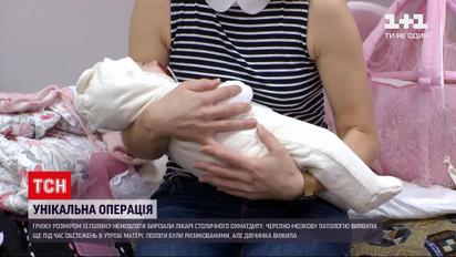 Уникальная операция: врачи киевского "Охматдета" вырезали девочке редкую грыжу