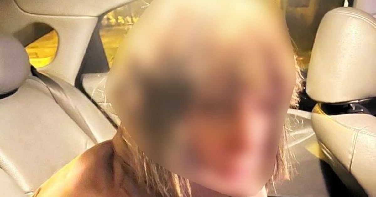 У Києві жінка тікала від поліції і врізалась у паркан