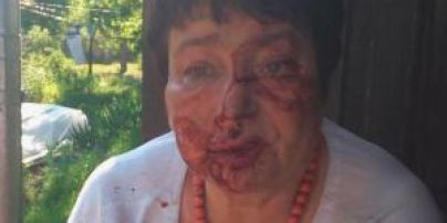 На Київщині на замовлення жорстоко побили голову ТВК Коцюбинського