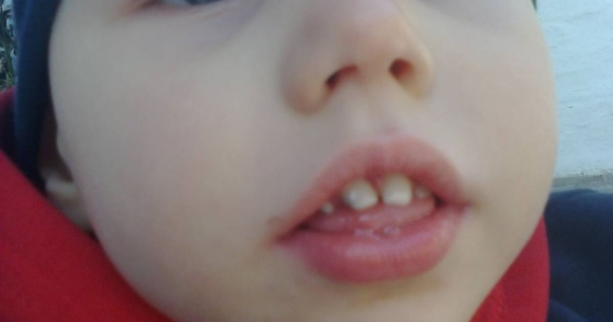 3-летний Богданчик надеется на помощь