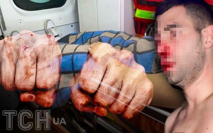 "Мала, ти їдеш з нами!": нові подробиці поліцейського скандалу на Полтавщині