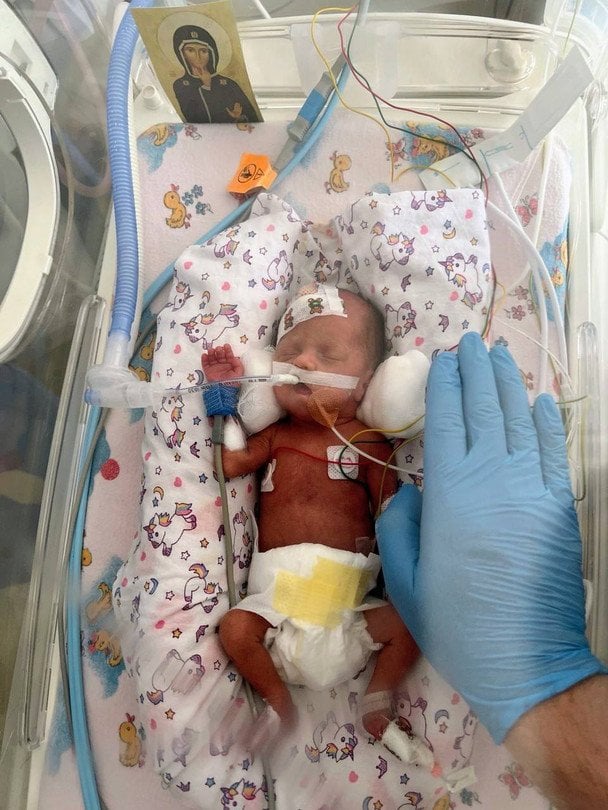 Дівчинка Евеліна з Тернопільщини Фото Дитячої лікарні Святого Миколая.