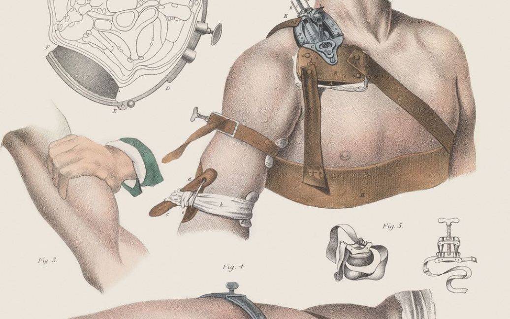 Хирургия 19-го века. / © thamesandhudson.com