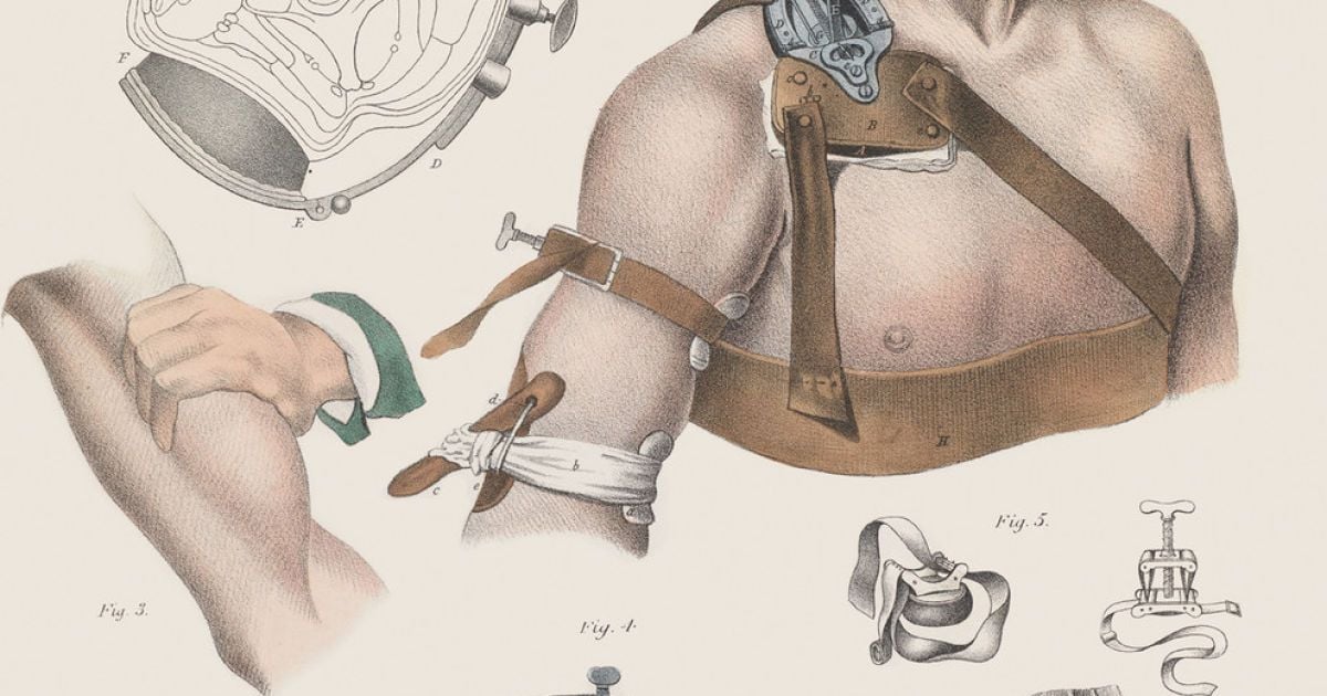 Хірургія 19-го століття. / © thamesandhudson.com