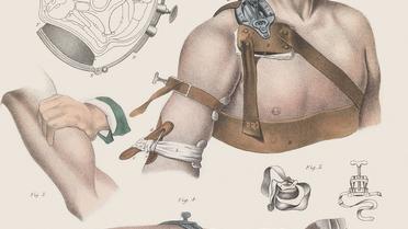 Хирургия 19-го века. / © thamesandhudson.com