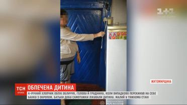 4-летний мальчик облился кипятком на Житомирщине