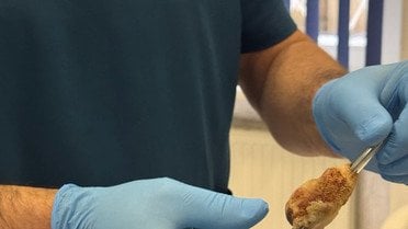 вятигли термометр з сечового_3 / © Університетська лікарня ЛНМУ імені Данила Галицького