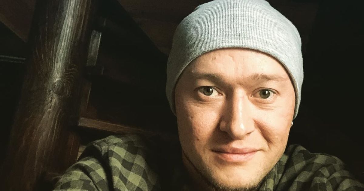 Андрей Хлывнюк показал, как выглядит его лицо после обстрела оккупантами