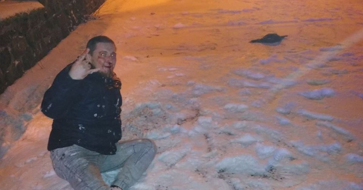 В Ужгороде неизвестные с криками "Анти-антифа" избили местного журналиста