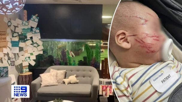 Мама забрала сина з ясел із подряпаним обличчям / © 9news.com.au