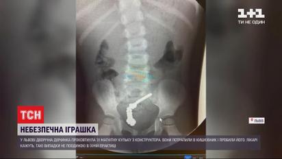 Маленькую львовянку чуть не убила популярная игрушка