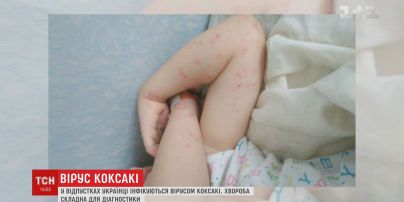 Украинцы, возвращаясь из отпусков, везут домой опасные вирусы