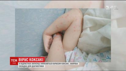 Українці, повертаючись із відпусток, везуть до дому небезпечні віруси